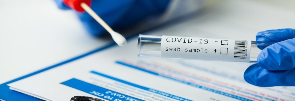 What is the main difference between PCR and serological test? Juaneda