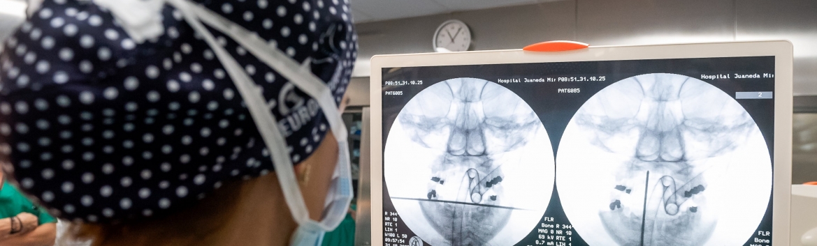 Juaneda Hospitales realiza una cirugía mundialmente innovadora y mínimamente invasiva de un tumor cervical Juaneda