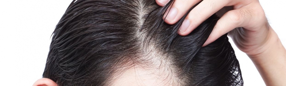 Non Shaven Fue: leading hair transplant technique  Juaneda