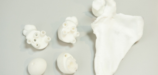Modelos óseos impresos en 3D para planificar y ensayar la cirugía traumatológica y ortopédica