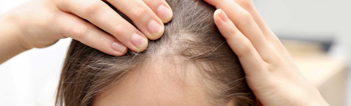 How to treat hair loss in women Juaneda