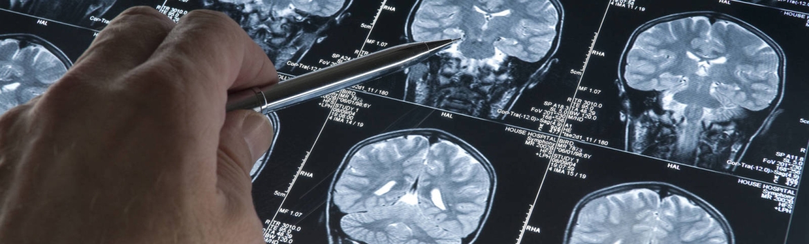 Juaneda Hospitales, helps to combat cognitive impairment Juaneda