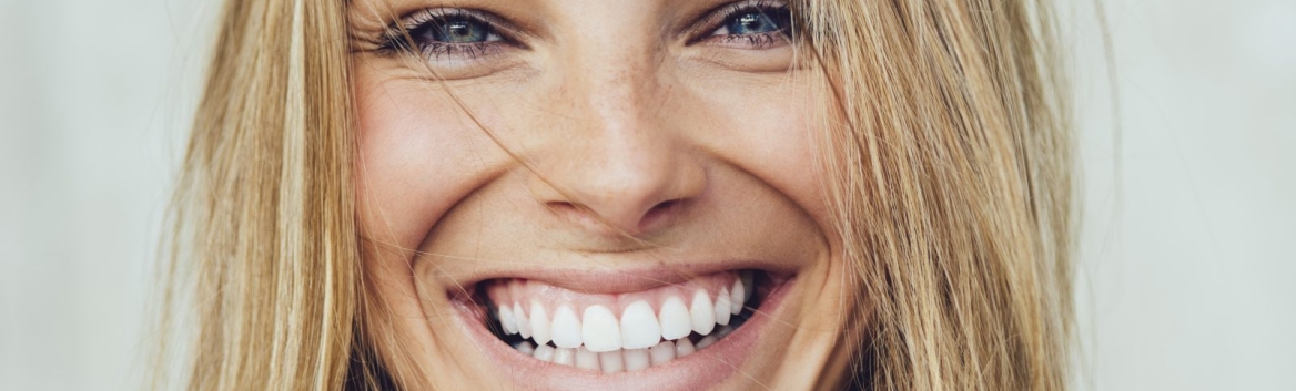 Hollywood smile, the design of a perfect smile Juaneda