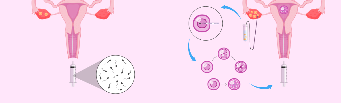 Differences between artificial insemination and in vitro fertilisation Juaneda