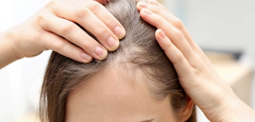 How to treat hair loss in women Juaneda