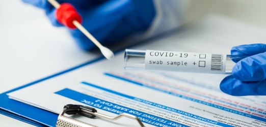 What is the main difference between PCR and serological test? Juaneda