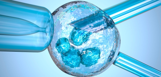 What is a preimplantation genetic diagnosis?  Juaneda