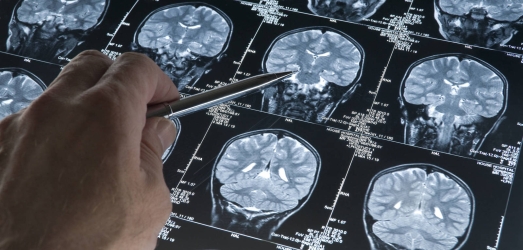 Juaneda Hospitales, helps to combat cognitive impairment Juaneda