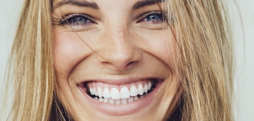 Hollywood smile, the design of a perfect smile Juaneda