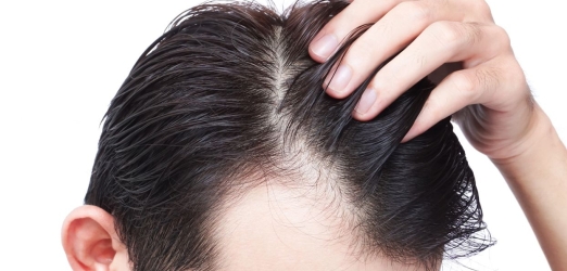 Non Shaven Fue: leading hair transplant technique  Juaneda