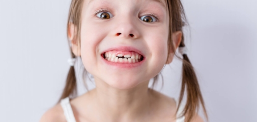 Los dientes de leche de mis hijos están separados, ¿es normal? Juaneda
