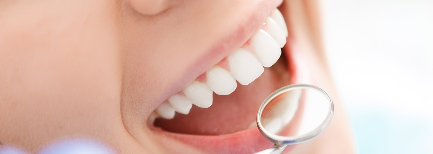 Mejora tu sonrisa con los tratamientos dentales estéticos disponibles en Juaneda dental.